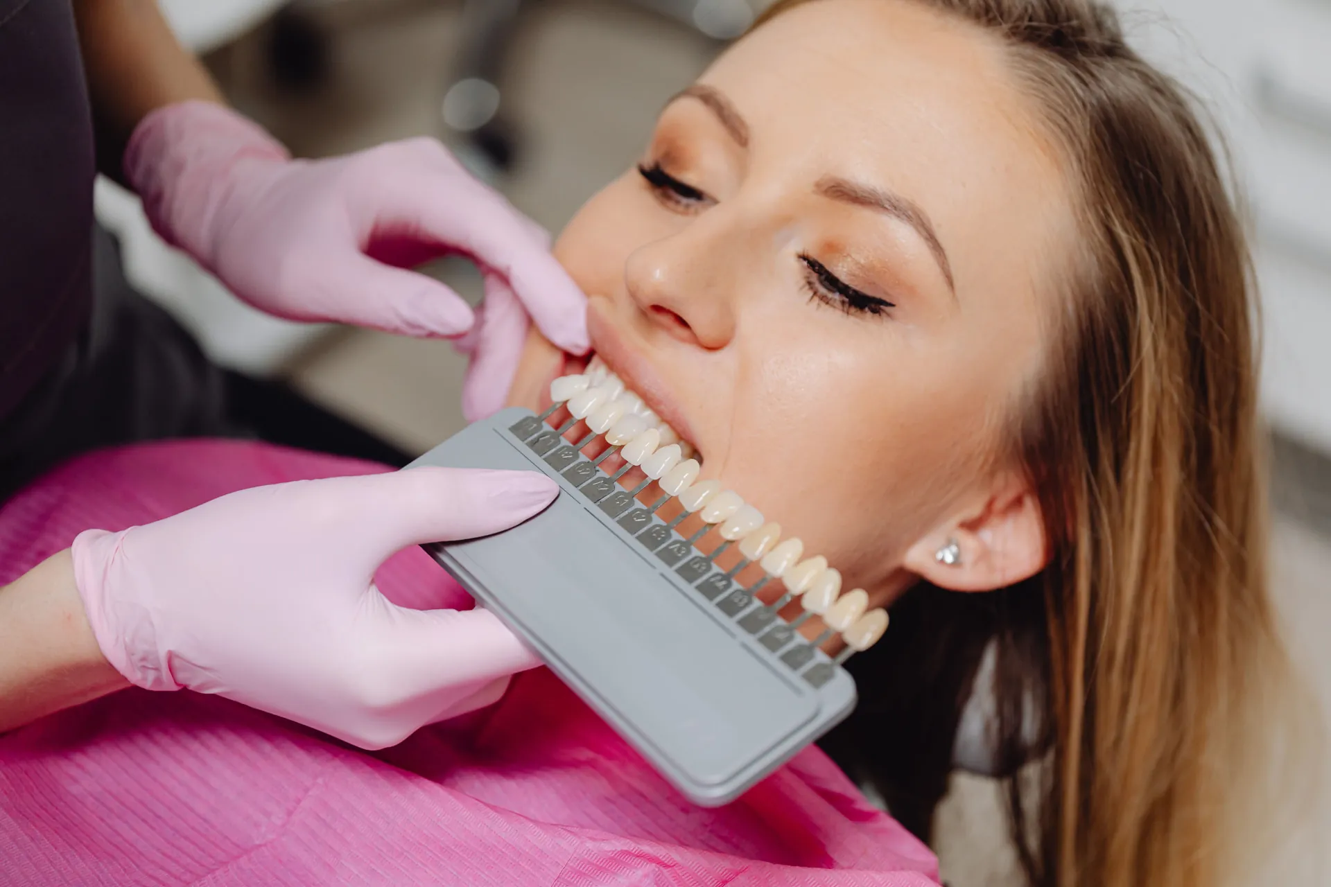 Blanqueamiento Dental